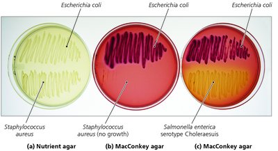MacConkey agar and nutrient agar with different bacteria
