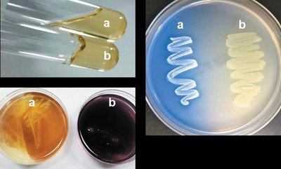 Detection of exoenzymes in bacterial cultures
