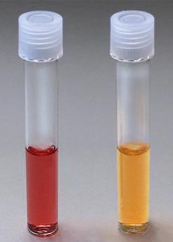 Mannitol Salt Agar: pH indicator