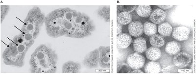 Reverse TCA cycle diagram