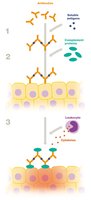 Type III hypersensitivity: Immune complex deposition and inflammation