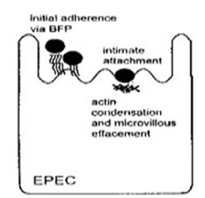 EPEC mechanism