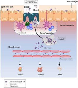 Pathogenesis of EHEC and HUS