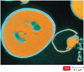 Inhibition of Bacterial Cell Wall Synthesis by Penicillin