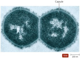 Streptococcus pneumoniae with capsule under TEM