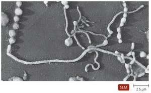 Mycoplasma pneumoniae under SEM