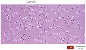 Klebsiella pneumoniae with capsule under light microscope