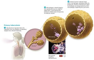 Primary tuberculosis pathogenesis in alveoli