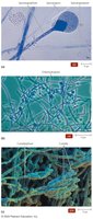 Representative asexual spores of molds