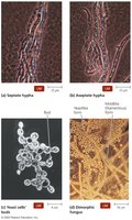 Fungal morphology: hyphae and yeast
