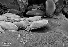 Protozoa under electron microscope