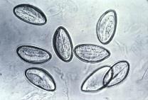 Helminth eggs under microscope