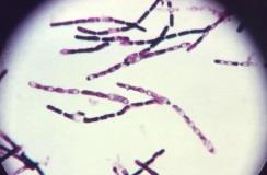 Bacillus anthracis under microscope