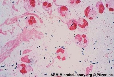 Gram stain of bacteria