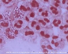 Neisseria gonorrhoeae under microscope
