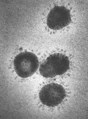 Coronavirus particles under electron microscope