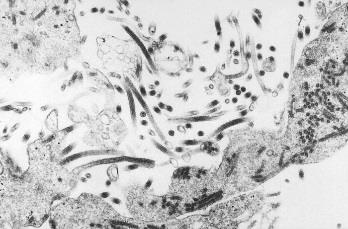 Filamentous virus particles