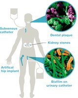 Biofilm formation on medical devices