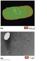 TEM and SEM images of bacterial chromosome