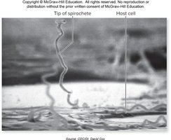 Spirochete (Treponema pallidum) attaching to host cell