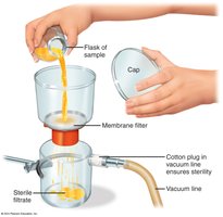 Diagram of membrane filtration setup