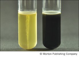 Sulfur reduction results: negative (yellow) and positive (black precipitate)