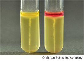 Indole production results: negative (yellow) and positive (red ring)