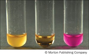 Urease test results: negative (yellow), control (orange), positive (pink)