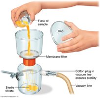 Membrane filtration setup