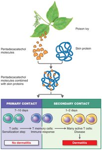 Poison ivy-induced contact dermatitis mechanism