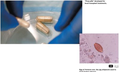 Fecal transplant capsules and whipworm egg