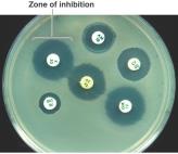 Kirby-Bauer disk diffusion test