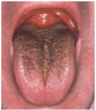 Therapeutic range and toxicity of drugs