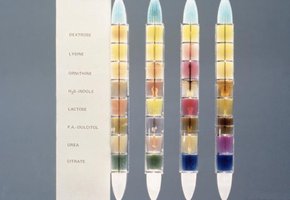 Enterotube identification kit