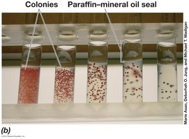 Agar dilution tubes with colonies