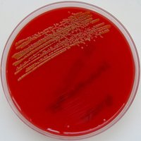 Culture on blood agar