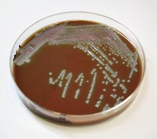 Chocolate agar with Francisella tularensis