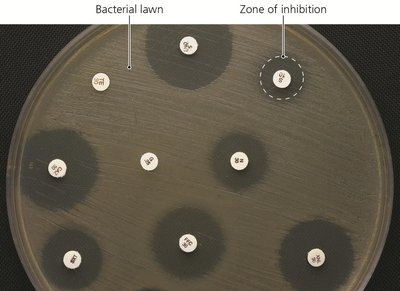 Kirby-Bauer test showing zones of inhibition