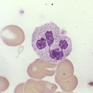 Granulocytes: Eosinophil, Basophil, Lymphocyte