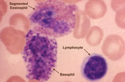 Blood smear with eosinophil, basophil, lymphocyte