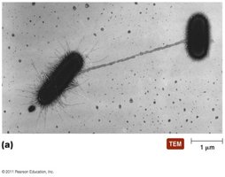 Transmission electron micrograph of bacterial conjugation via pilus