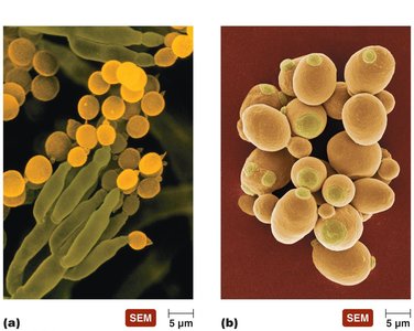 Fungal forms: spores, hyphae, budding cells