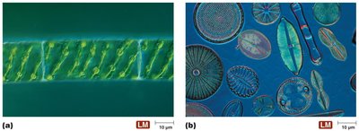 Algae: Spirogyra and diatoms