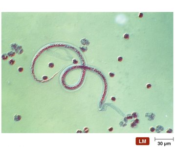 Immature stage of a parasitic worm in blood