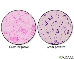 Gram stain: MedlinePlus Medical