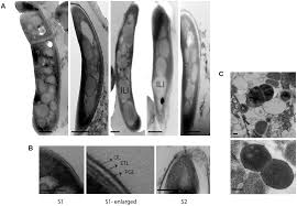 Mycobacterium tuberculosis Isolates ...