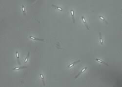Endospore - Wikipedia
