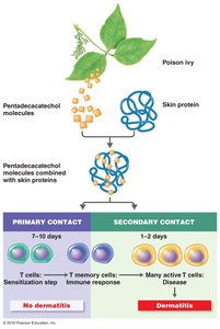 Mechanism of allergic contact dermatitis (poison ivy)