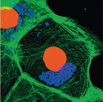 Fluorescence microscopy example