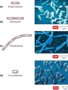 Bacillus arrangements and SEM images